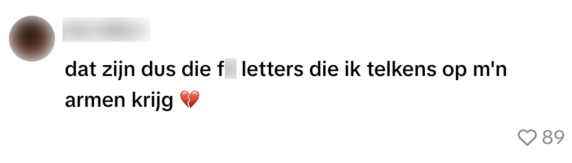 zonnebrand